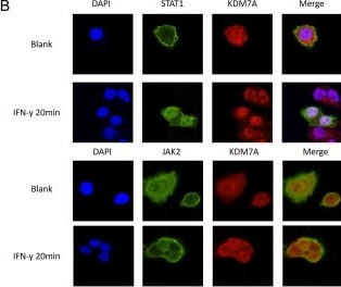 Fig.6.B showing Immunocytochemistry-immunofluorescence in a Homo sapiens (Human) sample from the publication: The dual functions of KDM7A in HBV replication and immune microenvironment.