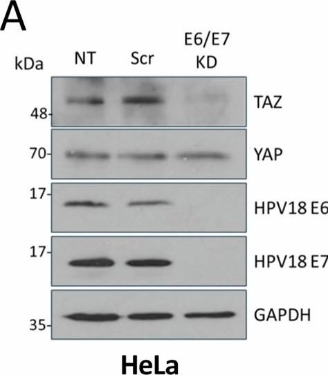 Fig.2.A showing Western Blotting in a Homo sapiens (Human) sample from the publication: The Hippo pathway transcription factors YAP and TAZ play HPV-type dependent roles in cervical cancer.
