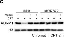 Fig.5.C showing Western Blotting from the publication: Hepatitis B virus infection disrupts homologous recombination in hepatocellular carcinoma by stabilizing resection inhibitor ADRM1.