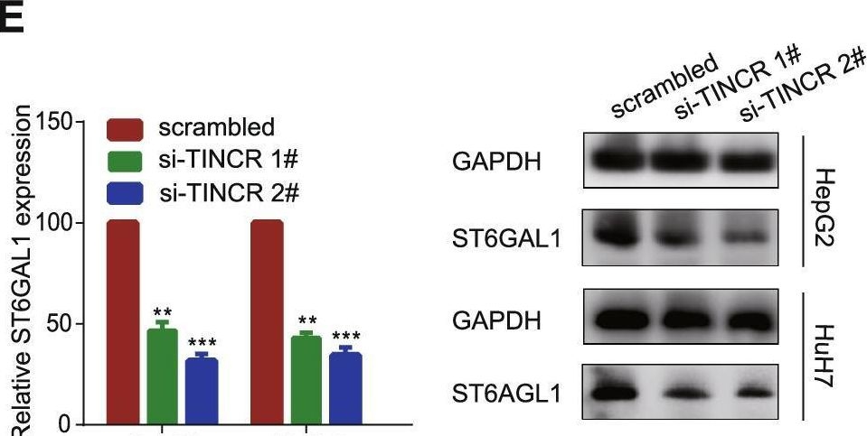 Fig.5.E showing Western Blotting in a Homo sapiens (Human) sample from the publication: Long noncoding RNA TINCR facilitates hepatocellular carcinoma progression and dampens chemosensitivity to oxaliplatin by regulating the miR-195-3p/ST6GAL1/NF-κB pathway.