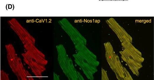 Fig.1.D showing Immunohistochemistry-immunofluorescence in a Mus musculus (House mouse) sample from the publication: Inducible over-expression of cardiac Nos1ap causes short QT syndrome in transgenic mice.