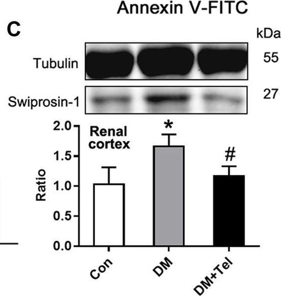 Fig.4.C showing Western Blotting from the publication: Anti-Apoptosis of Podocytes and Pro-Apoptosis of Mesangial Cells for Telmisartan in Alleviating Diabetic Kidney Injury.