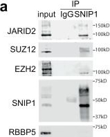 Fig.5.A showing Western Blotting from the publication: SNIP1 and PRC2 coordinate cell fates of neural progenitors during brain development.