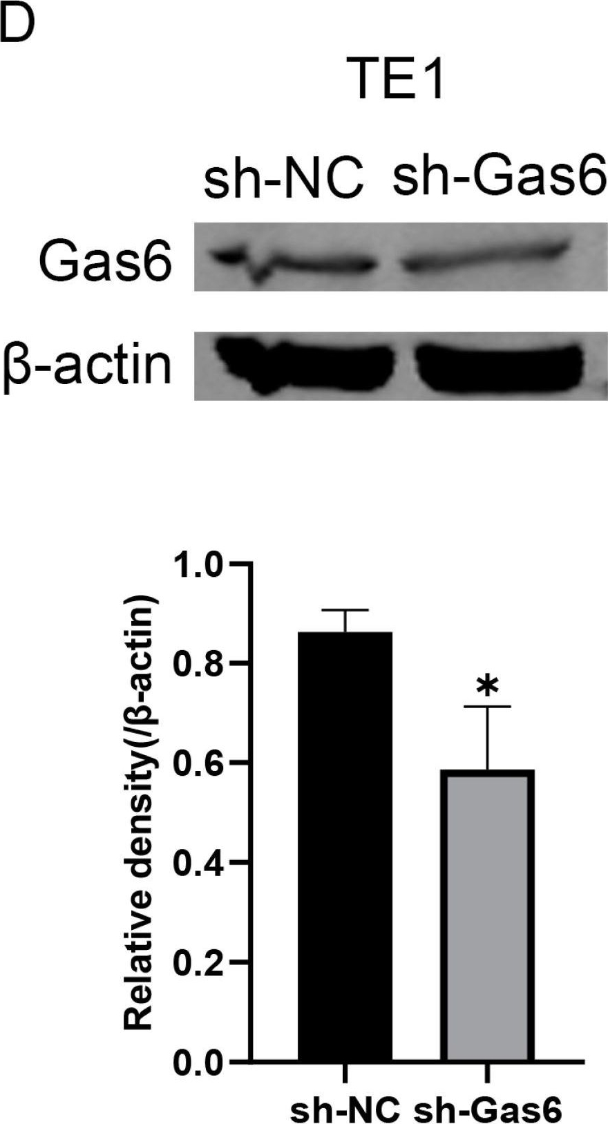 Fig.1.D showing Western Blotting in a Homo sapiens (Human) sample from the publication: Knockdown of Gas6 Exerts Anti-Esophageal Cancer Effects by Inhibiting the PI3K/AKT Pathway.