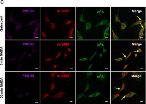 Fig.2.C showing Immunocytochemistry-immunofluorescence in a Homo sapiens (Human) sample from the publication: Global Co-regulatory Cross Talk Between m6A and m5C RNA Methylation Systems Coordinate Cellular Responses and Brain Disease Pathways.