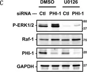 Fig.3.C showing Western Blotting in a Homo sapiens (Human) sample from the publication: PHI-1, an Endogenous Inhibitor Protein for Protein Phosphatase-1 and a Pan-Cancer Marker, Regulates Raf-1 Proteostasis.