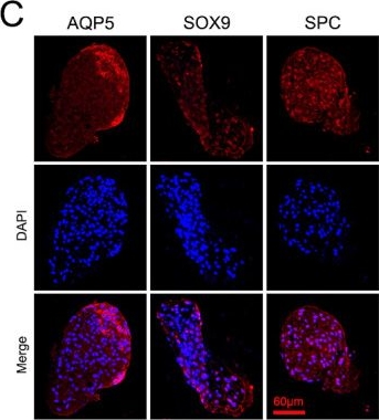 Fig.9.C showing Immunocytochemistry-immunofluorescence in a Homo sapiens (Human) sample from the publication: Integrating Mendelian randomization and multi-omics analysis unravels gut microbiota-driven metabolic mechanisms in sepsis and identifies diagnostic biomarkers through experimental validation.