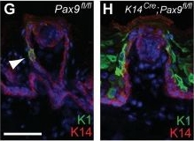 The formation of endoderm-derived taste sensory organs requires a Pax9-dependent expansion of embryonic taste bud progenitor cells.