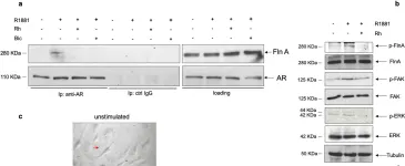 Fig.5.A showing Western Blotting from the publication: Filamin A cooperates with the androgen receptor in preventing skeletal muscle senescence.