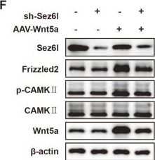 Fig.7.F showing Western Blotting in a Mus musculus (House mouse) sample from the publication: Sez6l promotes neuropathic pain via Wnt5a/Ca2+ pathways in dorsal root ganglion.