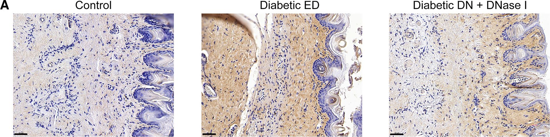Fig.5.A showing Immunohistochemistry from the publication: Neutrophil extracellular traps promote erectile dysfunction in rats with diabetes mellitus by enhancing NLRP3-mediated pyroptosis.