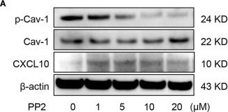 Fig.3.A showing Western Blotting in a Mus musculus (House mouse) sample from the publication: Dephosphorylation of Caveolin-1 Controls C-X-C Motif Chemokine Ligand 10 Secretion in Mesenchymal Stem Cells to Regulate the Process of Wound Healing.