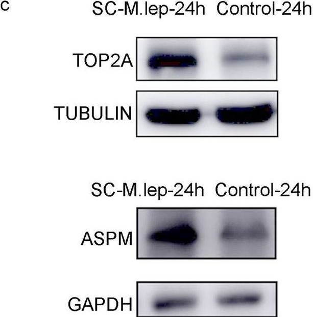 Fig.4.C showing Western Blotting in a Homo sapiens (Human) sample from the publication: Single-cell sequencing analysis reveals development and differentiation trajectory of Schwann cells manipulated by M. leprae.