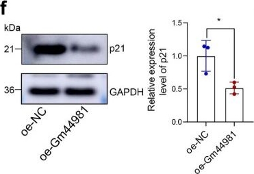 Fig.2.F showing Western Blotting from the publication: LncRNA Gm44981 modulates EZH2-H3K27me3-p21 axis to suppress mesangial cell senescence and kidney aging.