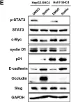 Fig.5.E showing Western Blotting from the publication: SHC4 promotes tumor proliferation and metastasis by activating STAT3 signaling in hepatocellular carcinoma.