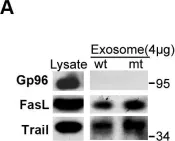 Fig.7.A showing Western Blotting from the publication: Exosome-related multi-pass transmembrane protein TSAP6 is a target of rhomboid protease RHBDD1-induced proteolysis.