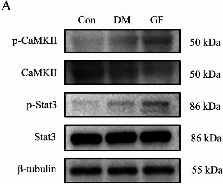 Fig.3.A showing Western Blotting from the publication: Glucose fluctuations aggravate myocardial fibrosis via activating the CaMKII/Stat3 signaling in type 2 diabtetes.