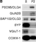 Fig.1.B showing Western Blotting from the publication: Human post-mortem synapse proteome integrity screening for proteomic studies of postsynaptic complexes.