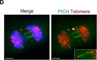 Fig.4.D showing Immunocytochemistry-immunofluorescence in a Homo sapiens (Human) sample from the publication: Human AAA+ ATPase FIGNL1 suppresses RAD51-mediated ultra-fine bridge formation.