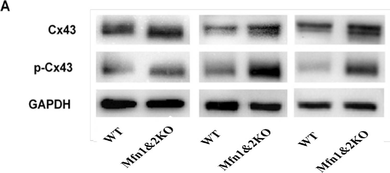 Fig.5.A showing Western Blotting in a Mus musculus (House mouse) sample from the publication: Role of cardiac mitofusins in cardiac conduction following simulated ischemia-reperfusion.