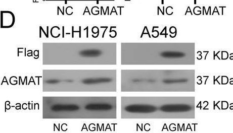 Fig.2.D showing Western Blotting in a Homo sapiens (Human) sample from the publication: Agmatinase promotes the lung adenocarcinoma tumorigenesis by activating the NO-MAPKs-PI3K/Akt pathway.