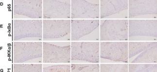 Phospho-IKK alpha/beta (Ser176/180) (16A6) Rabbit Monoclonal