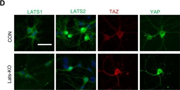 Fig.5.D showing Immunocytochemistry-immunofluorescence from the publication: Inhibition of Hippo Signaling Through Ablation of Lats1 and Lats2 Protects Against Cognitive Decline in 5xFAD Mice via Increasing Neuronal Resilience Against Ferroptosis.