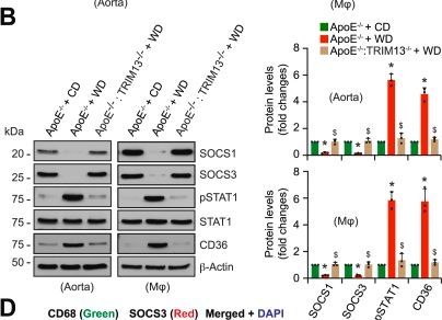 Fig.5.B showing Western Blotting from the publication: TRIM13 reduces cholesterol efflux and increases oxidized LDL uptake leading to foam cell formation and atherosclerosis.