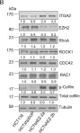 Fig.1.B showing Western Blotting from the publication: EZH2 regulates cofilin activity and colon cancer cell migration by targeting ITGA2 gene.
