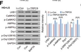 Fig.6.F showing Western Blotting in a Homo sapiens (Human) sample from the publication: Low-glucose-sensitive TRPC6 dysfunction drives hypoglycemia-induced cognitive impairment in diabetes.