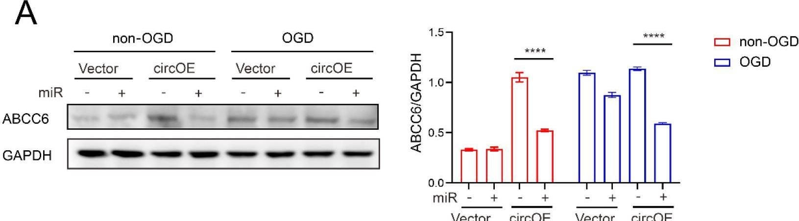 Fig.5.A showing Western Blotting from the publication: CircZXDC Promotes Vascular Smooth Muscle Cell Transdifferentiation via Regulating miRNA-125a-3p/ABCC6 in Moyamoya Disease.