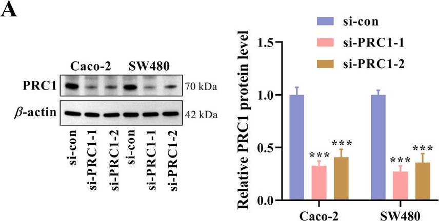 Fig.4.A showing Western Blotting in a Homo sapiens (Human) sample from the publication: Inhibition of PRC1 elicits immunogenic cell death by triggering ROS-dependent ER stress in colorectal cancer via the Wnt/β-catenin signaling pathway.