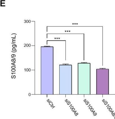 Fig.4.E showing Enzyme-linked immunosorbent assay from the publication: CD74 Promotes a Pro-Inflammatory Tumor Microenvironment by Inducing S100A8 and S100A9 Secretion in Pancreatic Cancer.