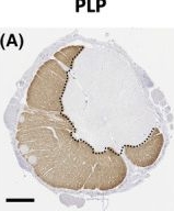 Fig.3.A showing Immunohistochemistry in a Homo sapiens (Human) sample from the publication: A role for vessel-associated extracellular matrix proteins in multiple sclerosis pathology.