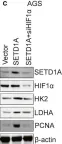Fig.5.C showing Western Blotting from the publication: Histone methyltransferase SETD1A interacts with HIF1α to enhance glycolysis and promote cancer progression in gastric cancer.