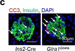 Fig.6.C showing Immunohistochemistry-immunofluorescence from the publication: Glycine-GLRA1-calmodulin signaling regulates endoplasmic reticulum calcium to sustain insulin secretion and β-cell function.
