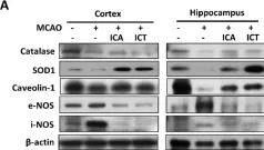 Fig.5.A showing Western Blotting from the publication: Bioactive Flavonoids Icaritin and Icariin Protect against Cerebral Ischemia-Reperfusion-Associated Apoptosis and Extracellular Matrix Accumulation in an Ischemic Stroke Mouse Model.