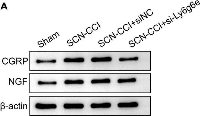 Fig.8.A showing Western Blotting in a Rattus norvegicus (Rat) sample from the publication: Exploring gene signatures and regulatory networks in a rat model of sciatica: implications and validation in neuropathic pain.