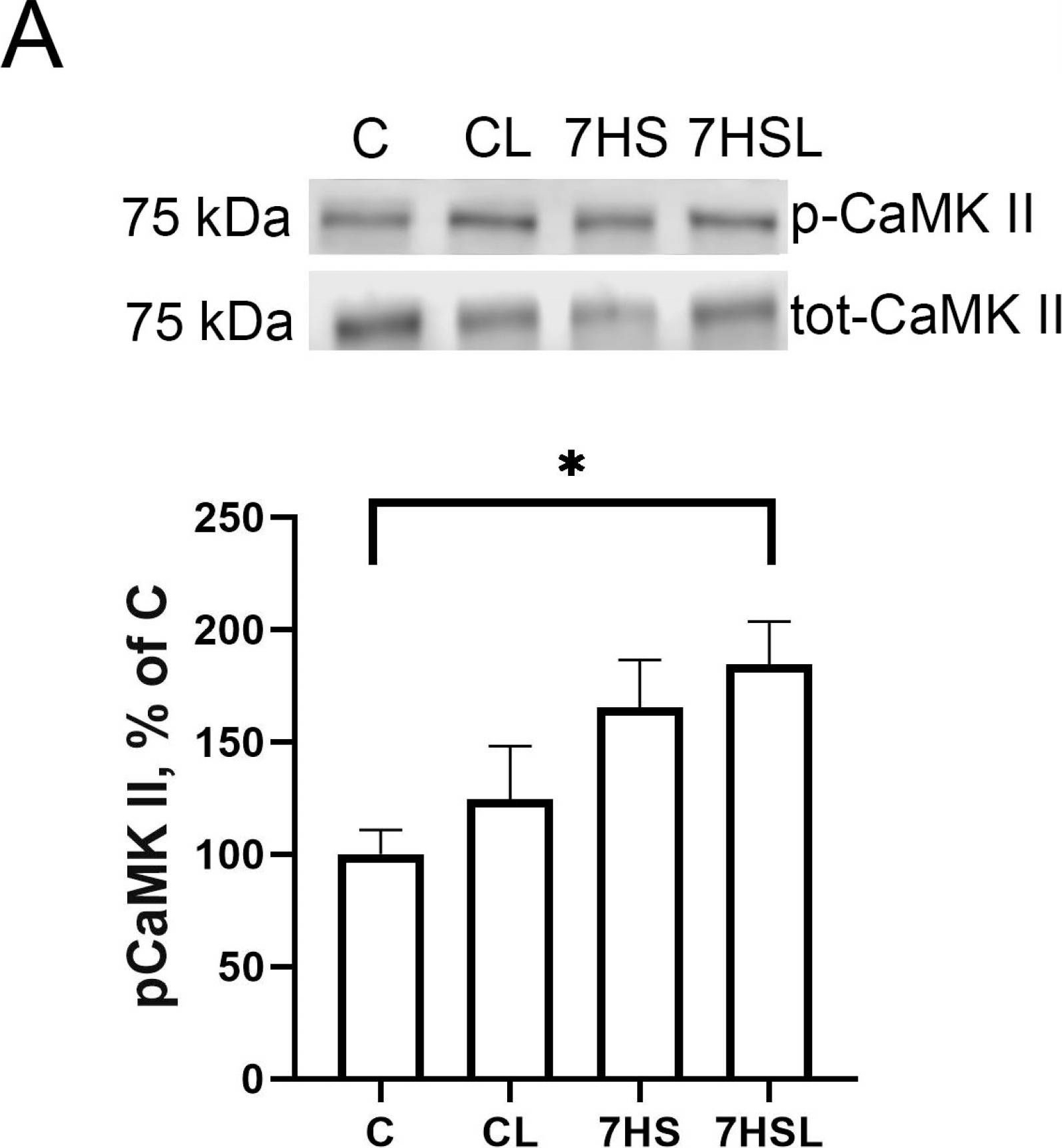 Fig.10.A showing Western Blotting in a Rattus norvegicus (Rat) sample from the publication: Molecular Signaling Effects behind the Spontaneous Soleus Muscle Activity Induced by 7-Day Rat Hindlimb Suspension.