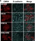 Fig.3.E showing Immunocytochemistry-immunofluorescence from the publication: EPHA2-dependent outcompetition of KRASG12D mutant cells by wild-type neighbors in the adult pancreas.