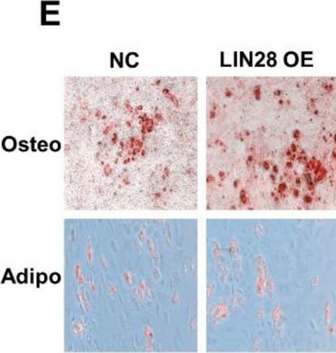 Fig.5.E showing Immunohistochemistry in a Homo sapiens (Human) sample from the publication: Antisense Oligonucleotides against Let-7 Enhance the Therapeutic Potential of Mesenchymal Stromal Cells.