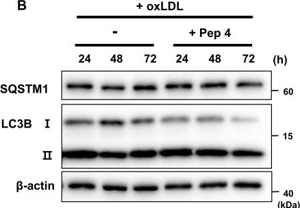 Fig.5.B showing Western Blotting in a Homo sapiens (Human) sample from the publication: A MAM-targeting therapeutic peptide restores autophagy homeostasis and ameliorates atherosclerosis.