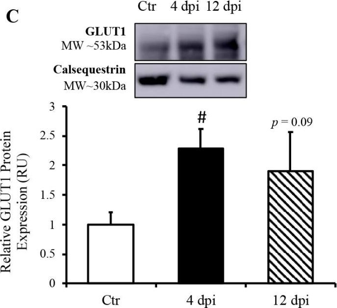 Fig.5.C showing Western Blotting in a Felis catus (Domesticated cat) sample from the publication: Impact of Delta SARS-CoV-2 Infection on Glucose Metabolism: Insights on Host Metabolism and Virus Crosstalk in a Feline Model.