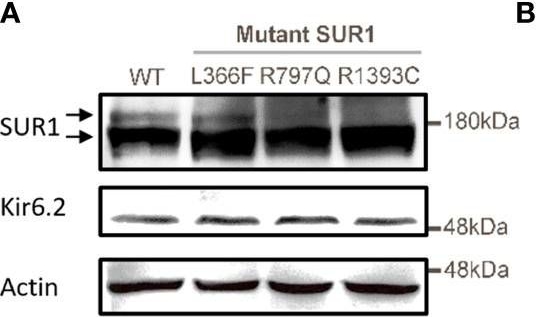 Fig.1.A showing Western Blotting in a Homo sapiens (Human) sample from the publication: Genotype-phenotype correlation in Taiwanese children with diazoxide-unresponsive congenital hyperinsulinism.