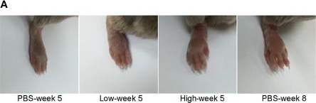 Fig.5.A from the publication: Natural Killer Cells Infiltration in the Joints Exacerbates Collagen-Induced Arthritis.