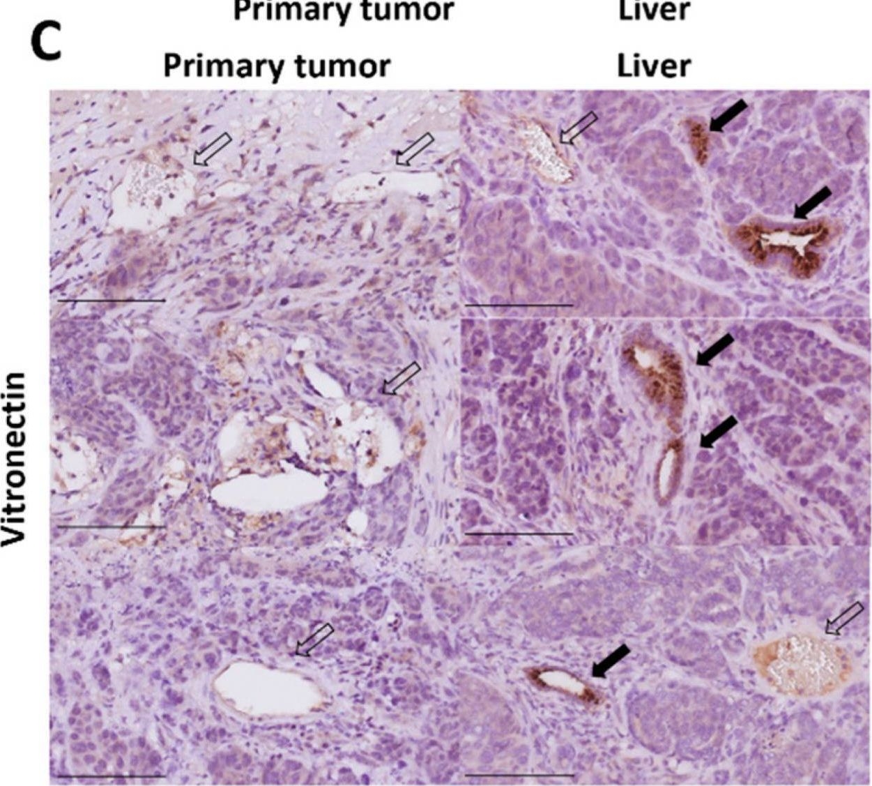 Fig.5.C showing Immunohistochemistry in a Mus musculus (House mouse) sample from the publication: Onward Spread from Liver Metastases Is a Major Cause of Multi-Organ Metastasis in a Mouse Model of Metastatic Colon Cancer.