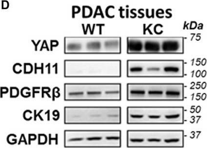 Fig.1.D showing Western Blotting from the publication: Yes-Associated Protein 1 Plays Major Roles in Pancreatic Stellate Cell Activation and Fibroinflammatory Responses.