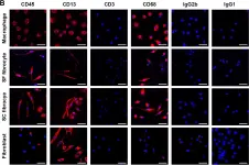 Fig.2.B showing Immunocytochemistry-immunofluorescence in a Homo sapiens (Human) sample from the publication: Distinct types of fibrocyte can differentiate from mononuclear cells in the presence and absence of serum.