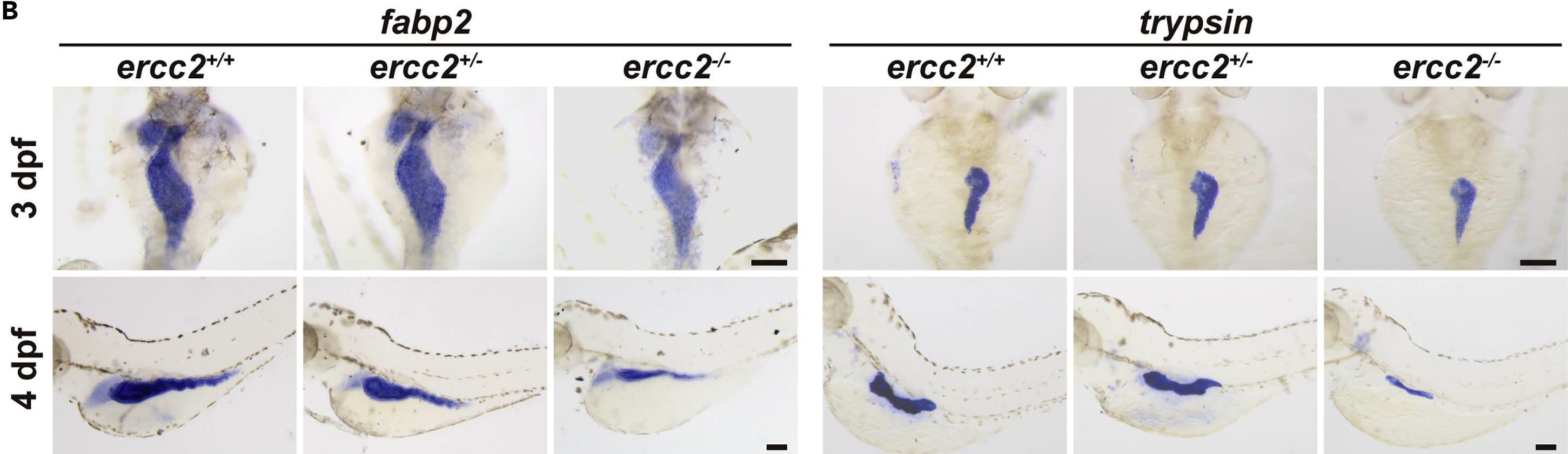 Fig.3.B showing Immunohistochemistry in a Danio rerio (Zebrafish) sample from the publication: Ercc2/Xpd deficiency results in failure of digestive organ growth in zebrafish with elevated nucleolar stress.