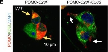 Fig.7.E showing Immunohistochemistry-immunofluorescence in a Mus musculus (House mouse) sample from the publication: Hypothalamic ER-associated degradation regulates POMC maturation, feeding, and age-associated obesity.